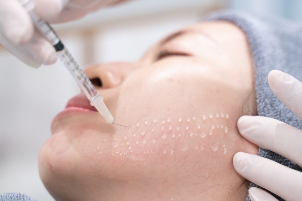 Mesoterapia