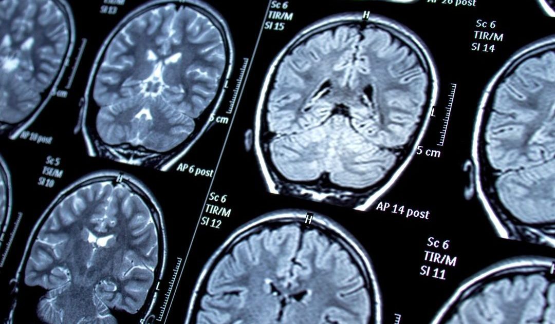 Neurologia